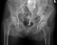 collage insertion vore hips x-ray skeleton shrunken_person