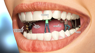 vore swimsuit teeth jeans shrunken_people inside_mouth femaleteeth