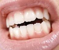 collage vore mouth teeth lips shrunken_men reaching giantess_katelyn shrunken_man reaching_out