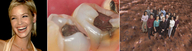 collage micro blonde mouth teeth short_hair face shrunken_people standing smile crowds giantesscity fillings