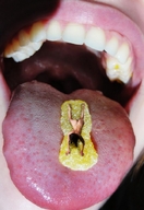 collage nude vore tongue mouth teeth shrunken_woman gummy