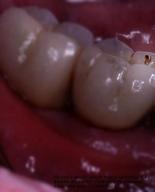 collage micro mouth teeth slave story shrunken_men shrunken_man cleaning