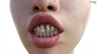 nude teeth brunette smiling shrunken_man between_teeth no_background digital_render teeth_clenched