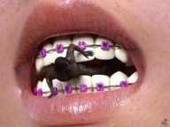 vore biting lips shrunken_man braces digital_render