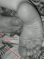 crush macro monochrome toes barefoot soles blood dialogue stuck_to_foot realistic