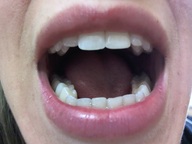 vore tongue teeth lips close_up point_of_view